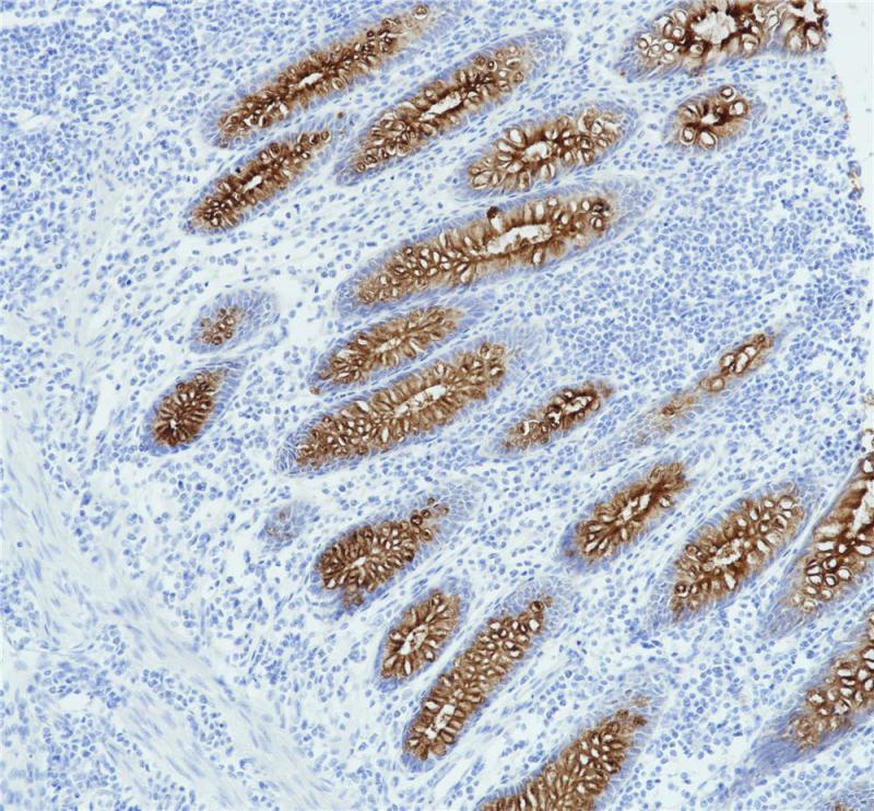 MUC4 Rabbit Monoclonal Antibody(ARB995)