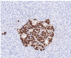 Glucagon Rabbit Monoclonal Antibody(ARB960)