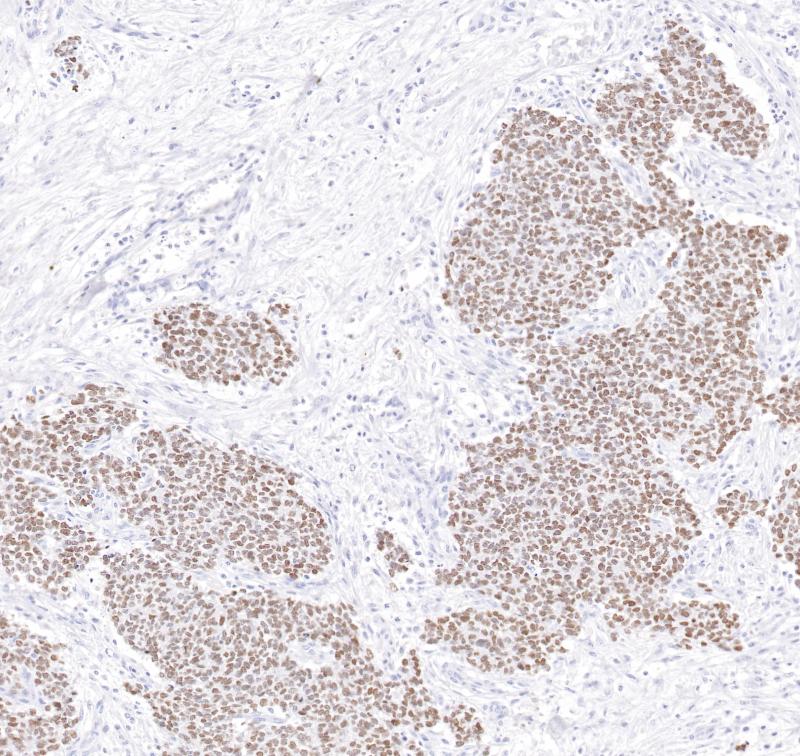 NKX2.2 Rabbit Monoclonal Antibody(ARB506)