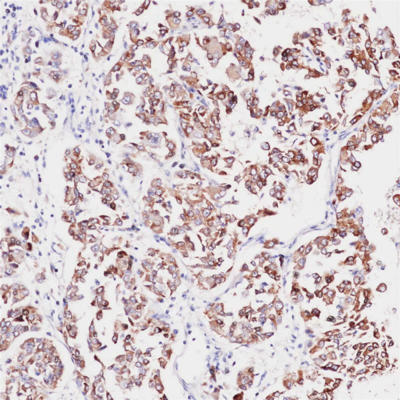 Melan A Rabbit Monoclonal Antibody(ARB987)
