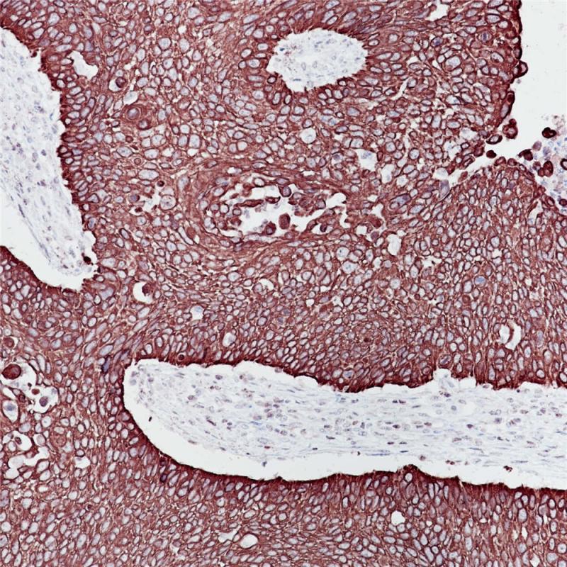 Cytokeratin 6 Rabbit Monoclonal Antibody(ARB940)