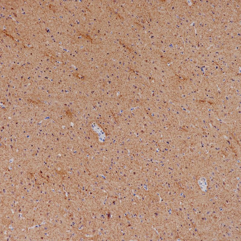 Neurofilament Mouse Monoclonal Antibody(ARB505)
