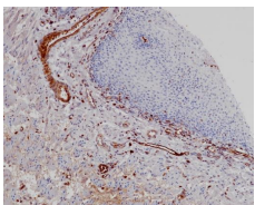 Hemoglobin alpha chain Rabbit Monoclonal Antibody(ARB968)