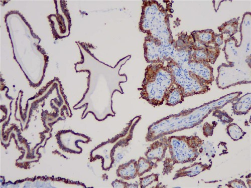 Cytokeratin 19 Rabbit Monoclonal Antibody(ARB937)