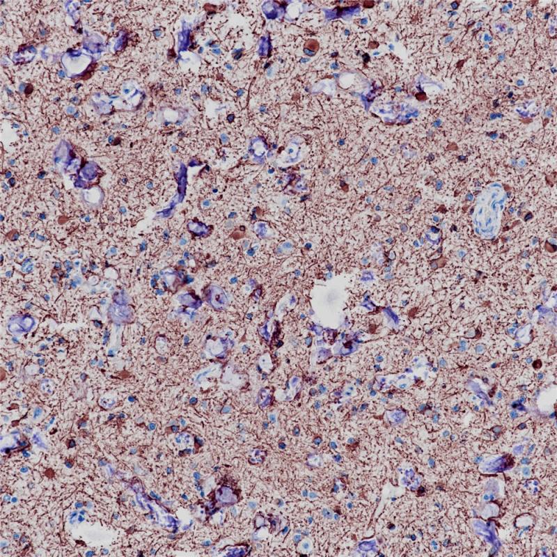 GFAP Rabbit Monoclonal Antibody(ARB959)
