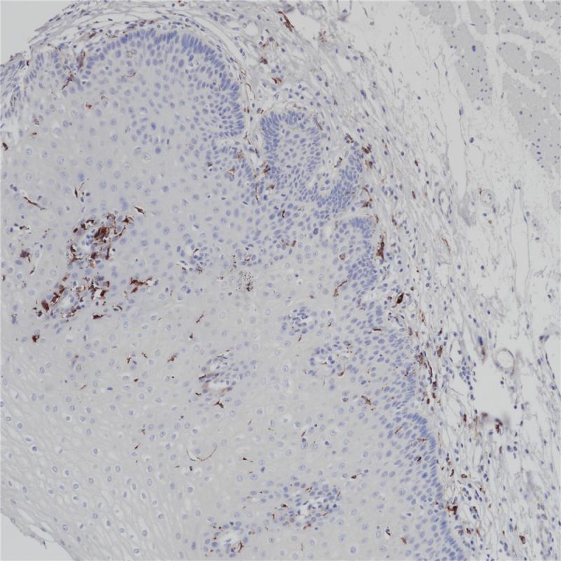 MHC Ⅱ(DR &alpha; chain) Rabbit Monoclonal Antibody(ARB991)