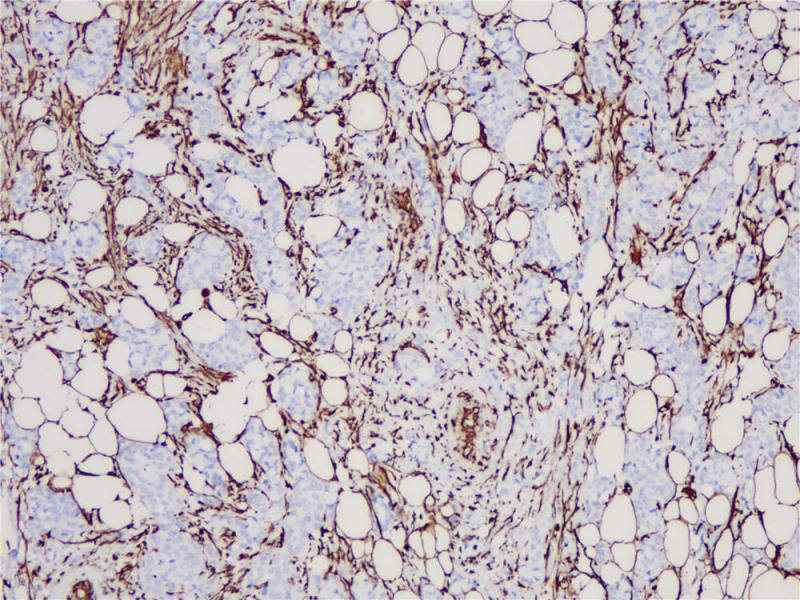 Vimentin Rabbit Monoclonal Antibody(ARB570)