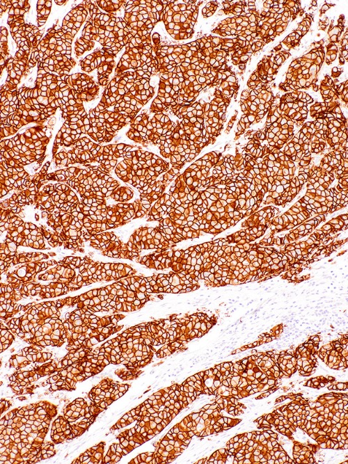 Her2/Neu Mouse Monoclonal Antibody(ARM862)
