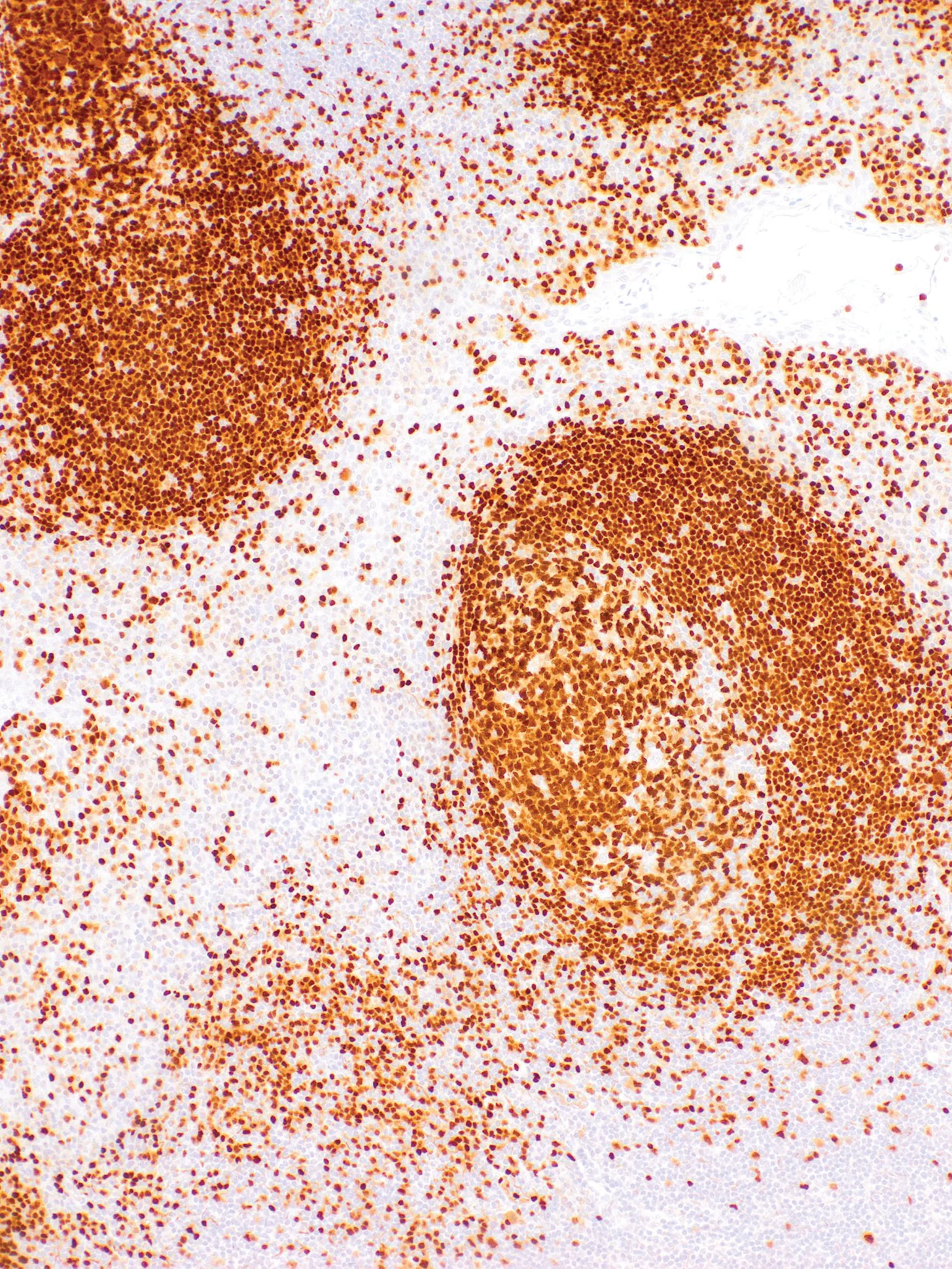 PAX-5 Rabbit Monoclonal Antibody(ARM870)