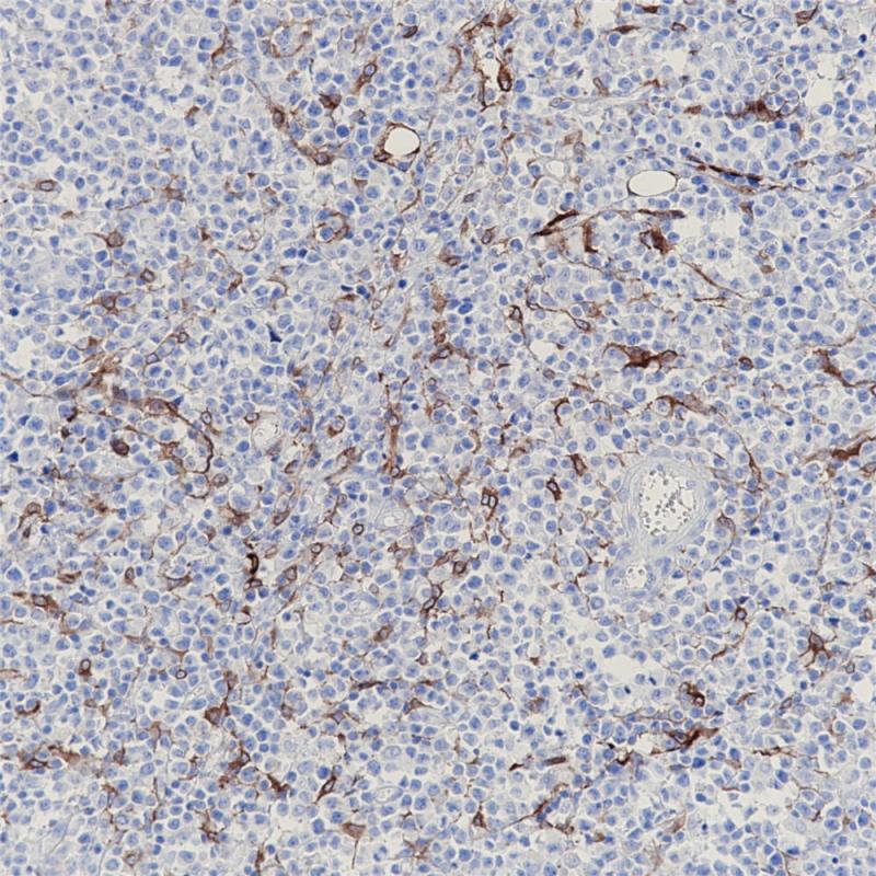 Podoplanin Rabbit Monoclonal Antibody(ARB531)