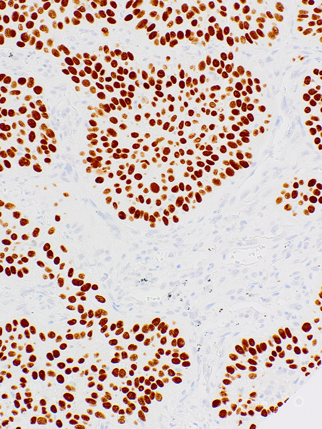 p40 Mouse Monoclonal Antibody(ARM865)