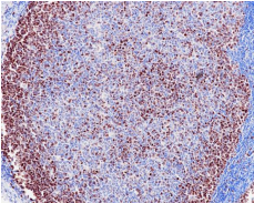 Survivin Rabbit Monoclonal Antibody(ARB555)