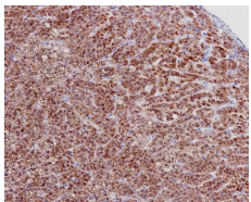 StAR Rabbit Monoclonal Antibody(ARB551)