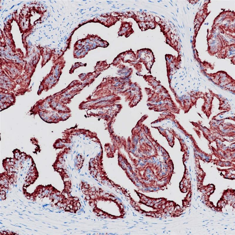 PSAP Rabbit Monoclonal Antibody(ARB535)