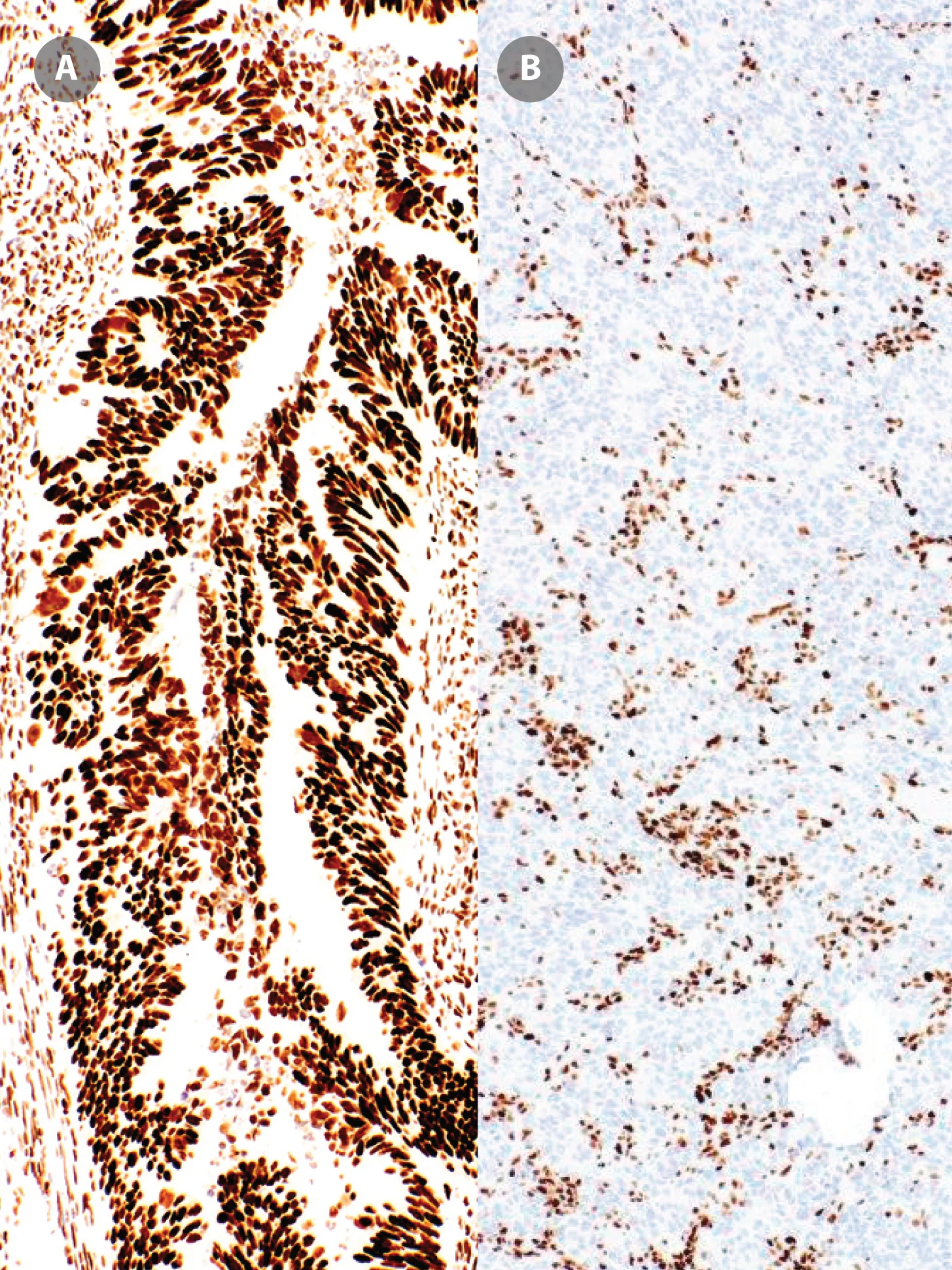 MSH6 Rabbit Monoclonal Antibody(ARM860)