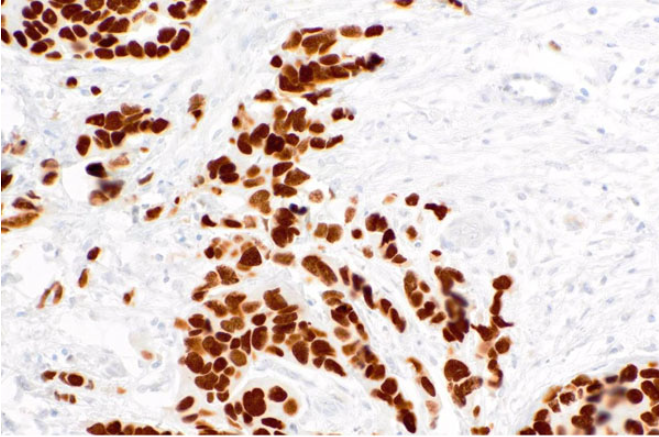 FOXP1  Mouse Monoclonal Antibody(ARM907)