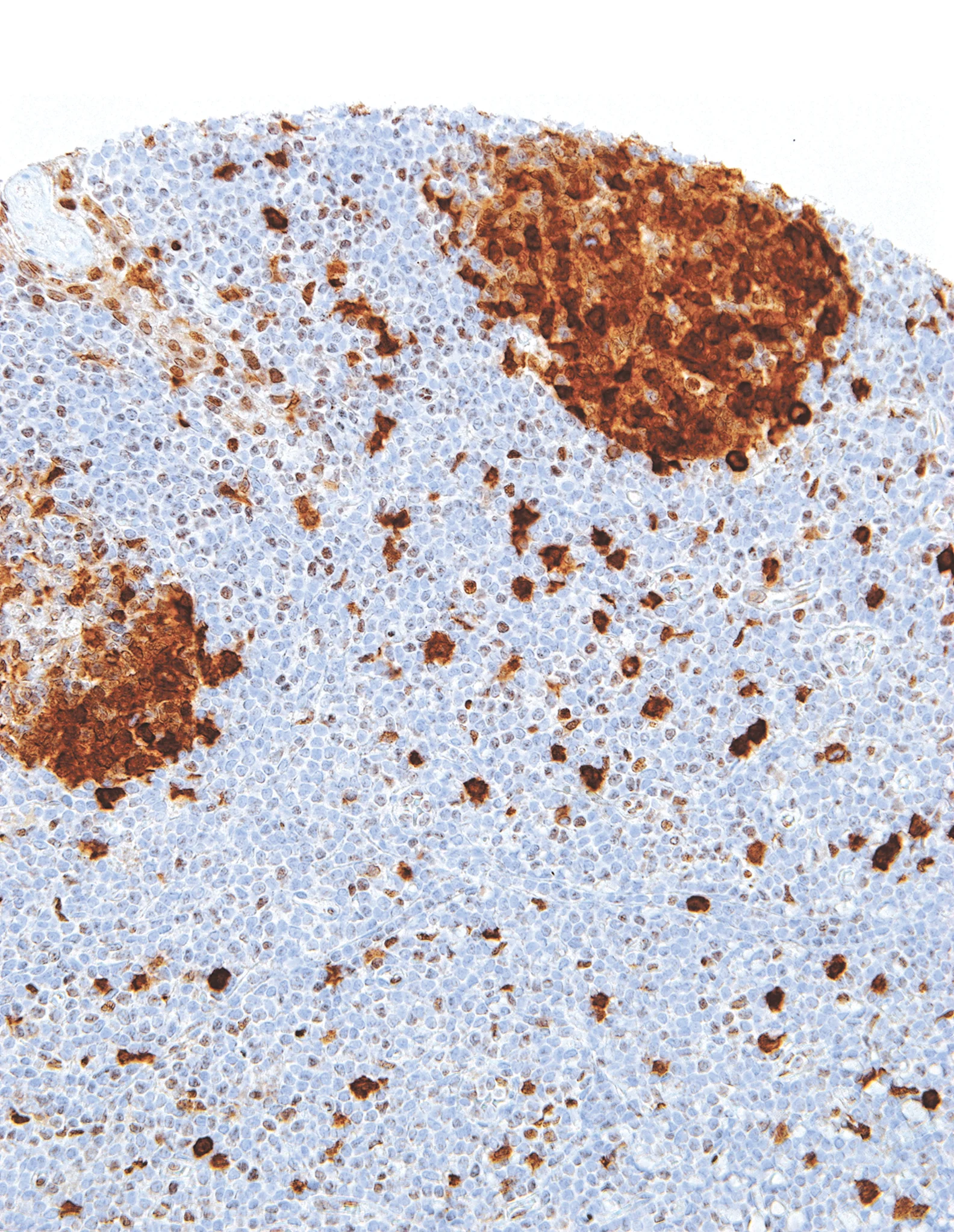 Thymidylate Synthase Mouse Monoclonal Antibody(ARM908)