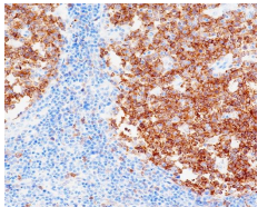 Stathmin Rabbit Monoclonal Antibody(ARB554)