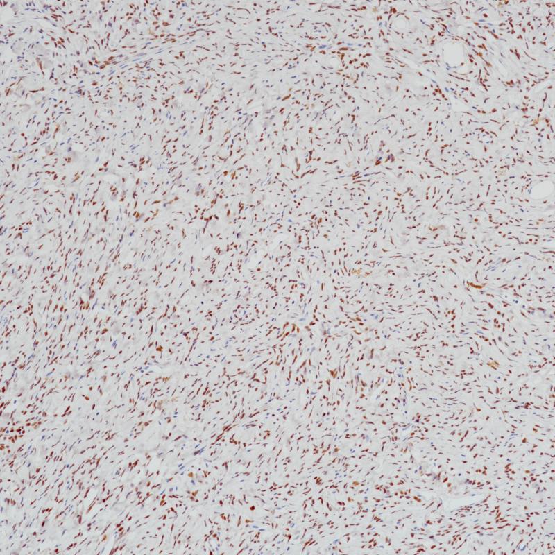 STAT6 Rabbit Monoclonal Antibody(ARB552)