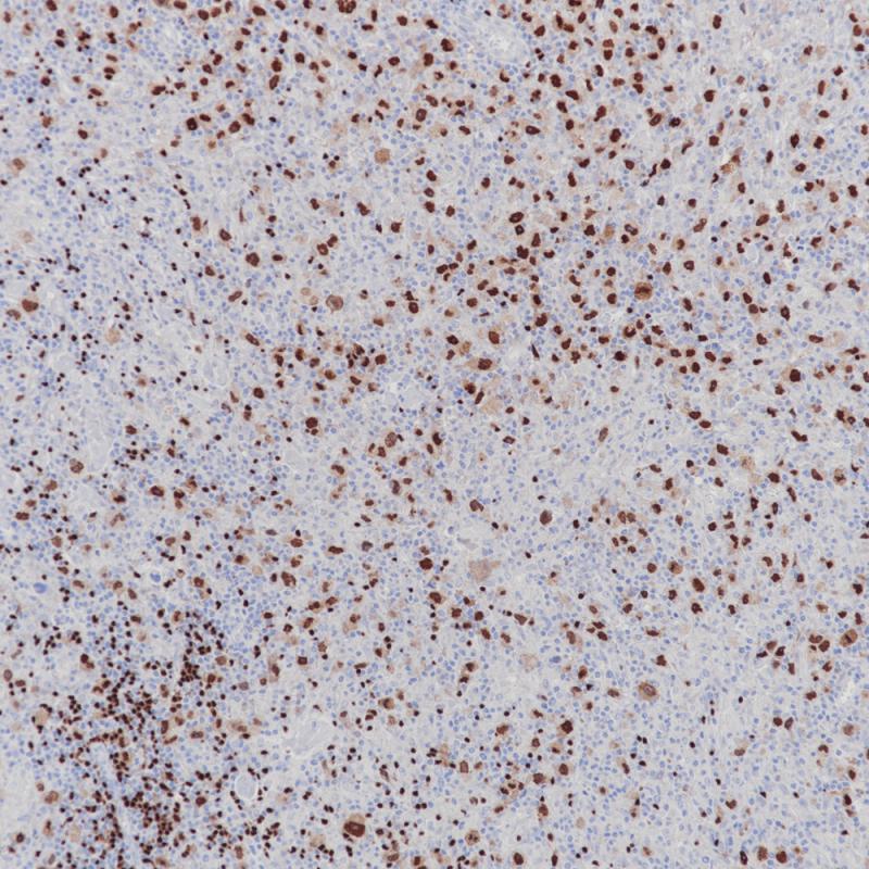 PAX-5 Rabbit Monoclonal Antibody(ARB522)