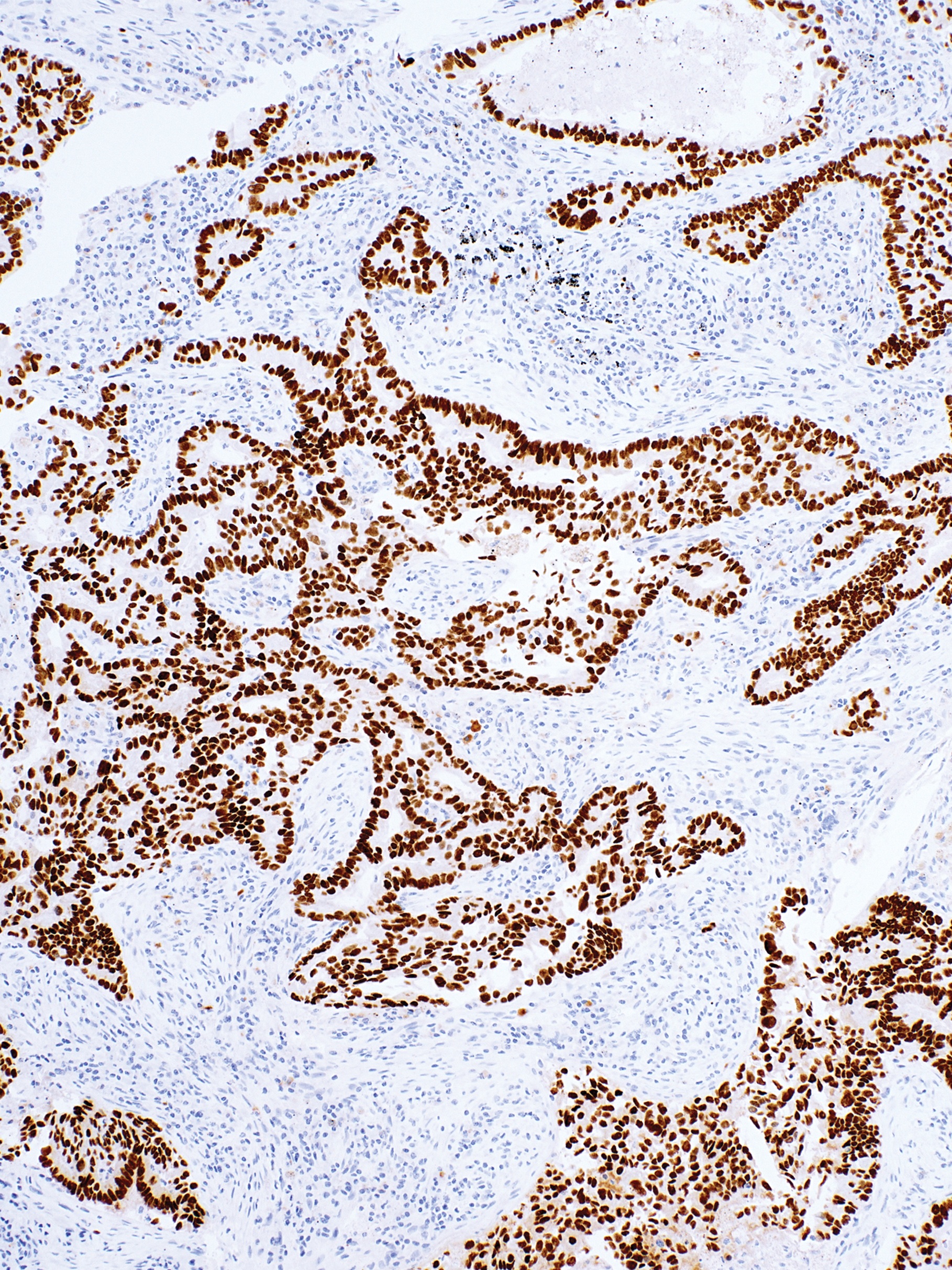 TTF-1 Rabbit Monoclonal Antibody(ARM875)