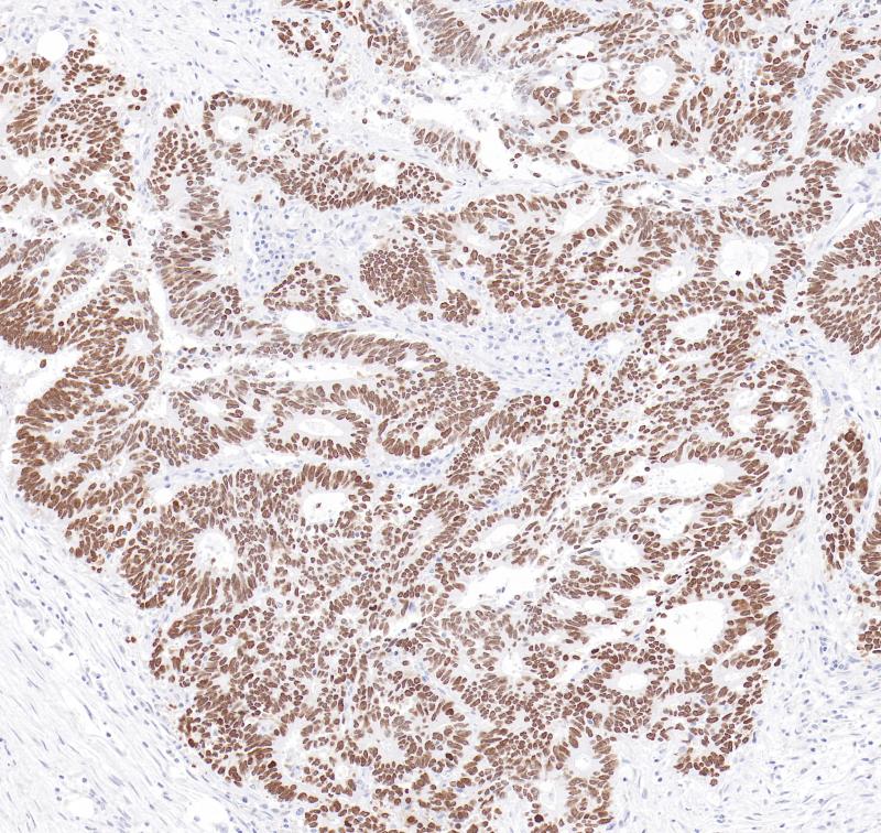 SATB2 Rabbit Monoclonal Antibody(ARB544)