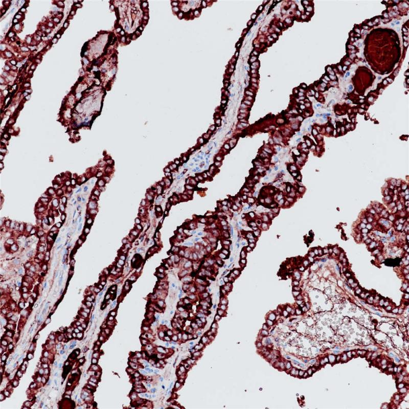 Thyroglobulin Rabbit Monoclonal Antibody(ARB558)