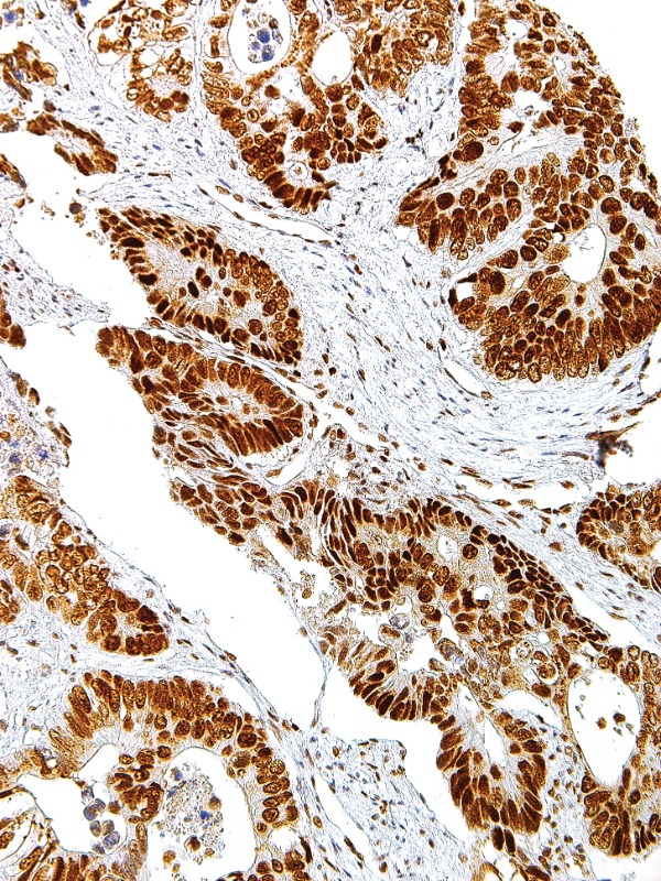 MLH1 Mouse Monoclonal Antibody(ARM879)