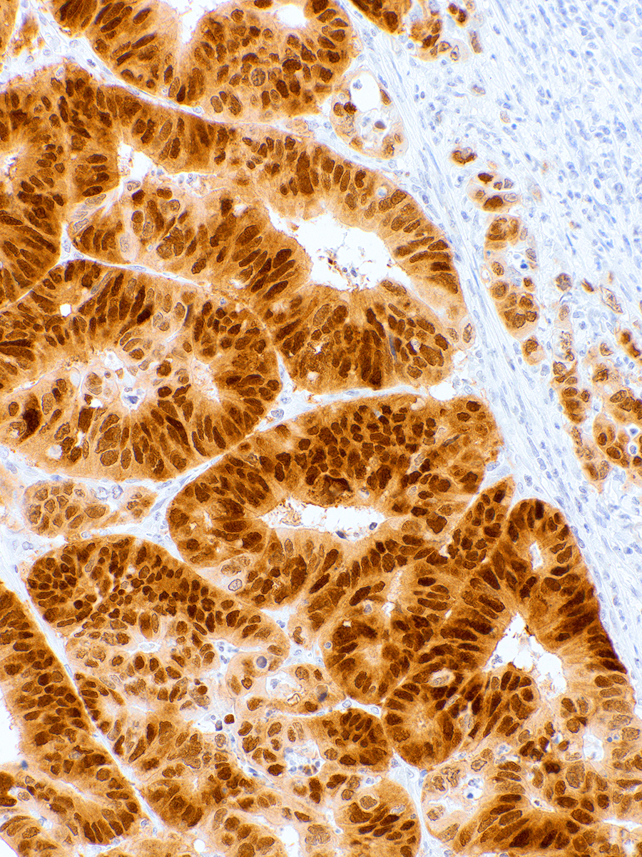 CDX-2 Rabbit Monoclonal Antibody(ARM878)