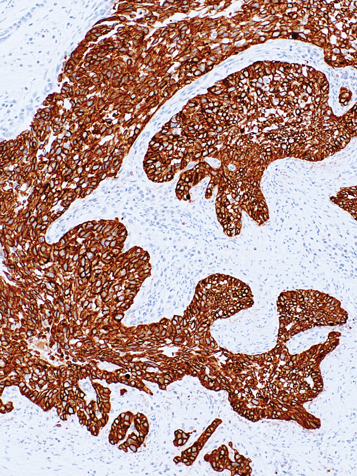 Cytokeratin (AE1/AE3) Mouse Monoclonal Antibody(ARM864)