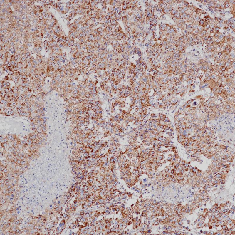 VEGF Rabbit Monoclonal Antibody(ARB568)