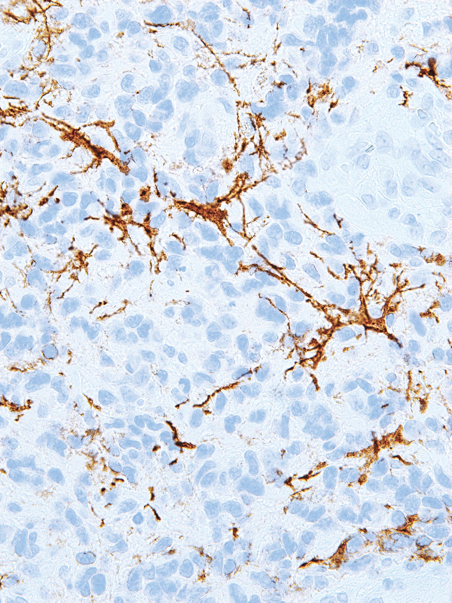 Nerve Growth Factor Receptor (NGFR) Mouse Monoclonal Antibody(ARM894)