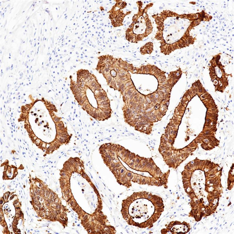Villin Rabbit Monoclonal Antibody(ARB569)