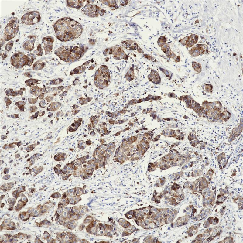 RRM1 Rabbit Monoclonal Antibody(ARB540)