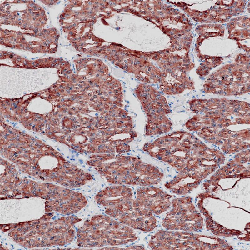 TPO Rabbit Monoclonal Antibody(ARB564)