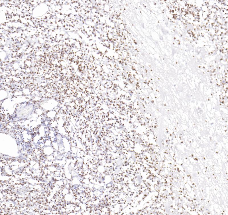 TIA-1 Rabbit Monoclonal Antibody(ARB559)