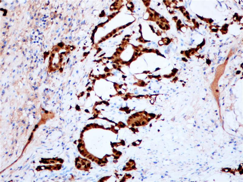 S100P Rabbit Monoclonal Antibody(ARB541)