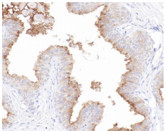 PSMA Rabbit Monoclonal Antibody(ARB536)
