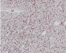 STAT6 Rabbit Monoclonal Antibody(ARB553)