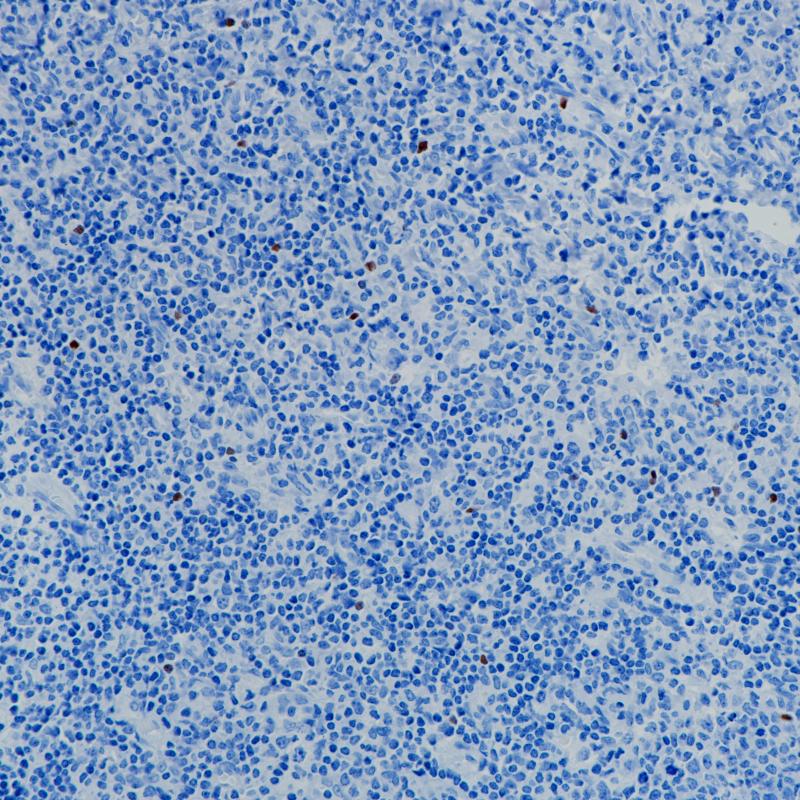 ROR gamma T Rabbit Monoclonal Antibody(ARB538)