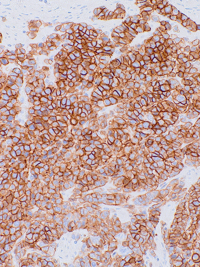 CD56 Rabbit Monoclonal Antibody(ARM867)