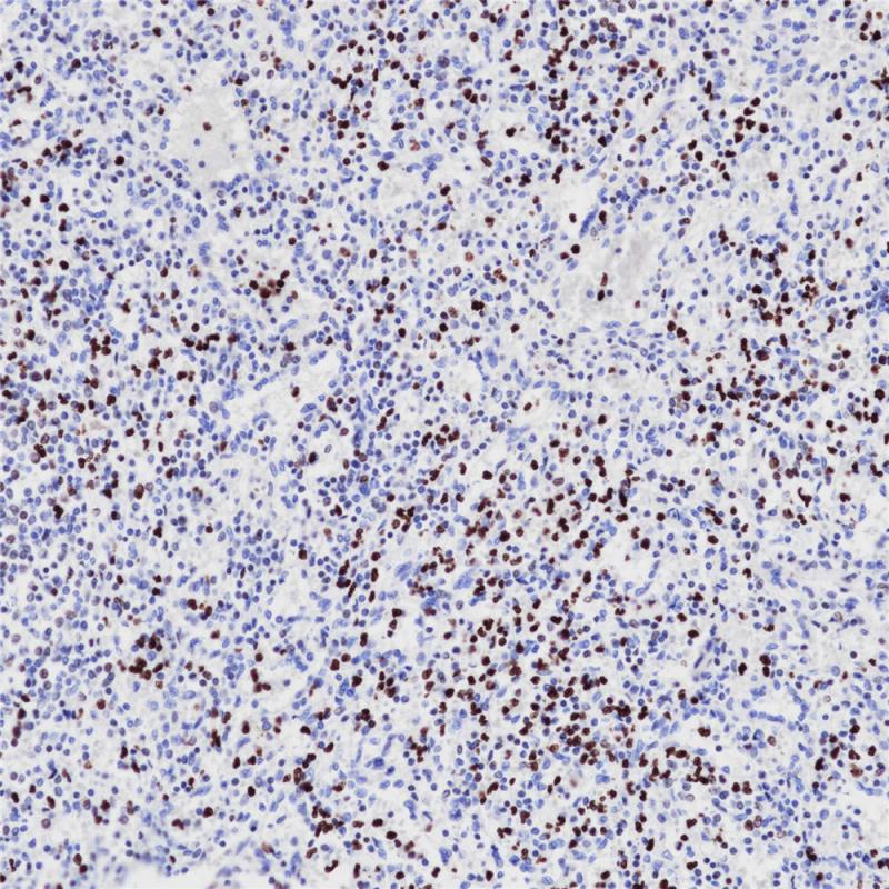Phosphohistone H3 (PHH3) Rabbit Monoclonal Antibody(ARB526)
