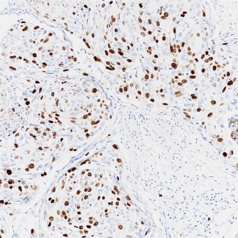 Topoisomerase II-&alpha; Rabbit Monoclonal Antibody(ARB563)