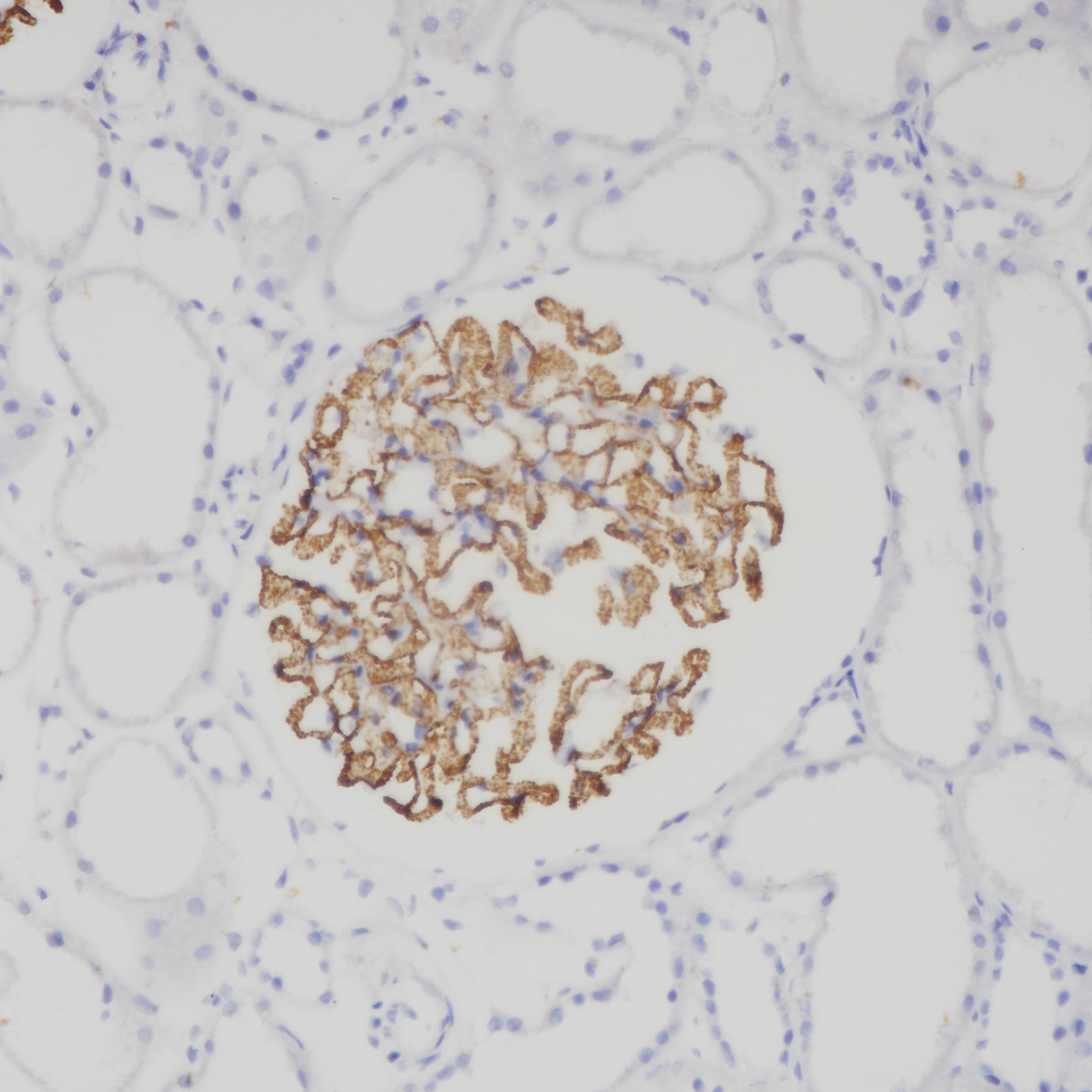 PLA2R Rabbit Monoclonal Antibody(ARB528)