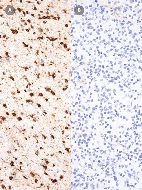 IDH1 R132H Mouse Monoclonal Antibody(ARM873)