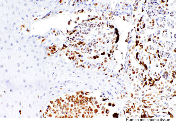 PRAME Rabbit Monoclonal Antibody(ARM869)