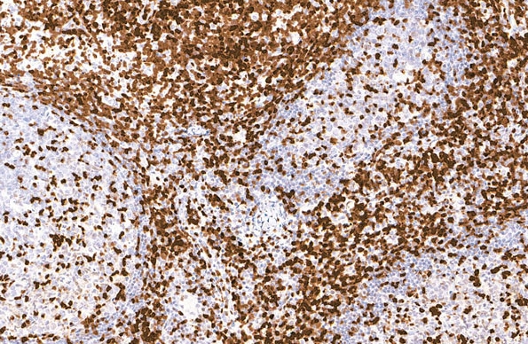 ZAP-70 Mouse Monoclonal Antibody(ARM909)
