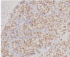 SALL4 Rabbit Monoclonal Antibody(ARB543)