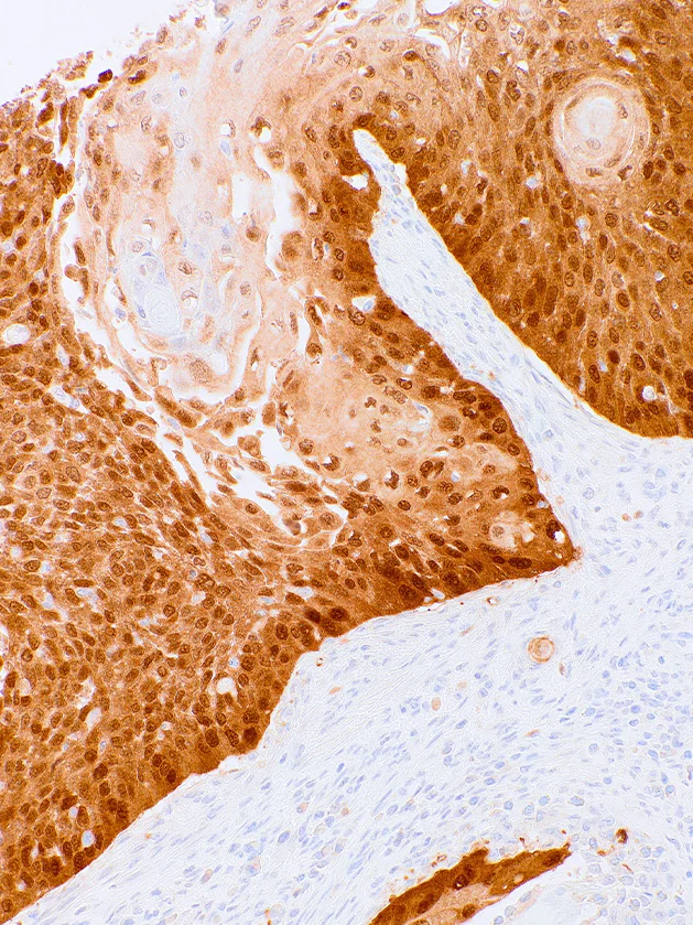 p16 Mouse Monoclonal Antibody(ARM877)