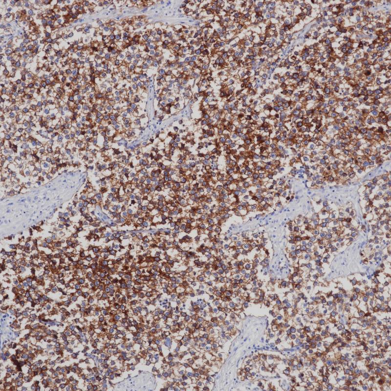 PLAP Mouse Monoclonal Antibody(ARB529)